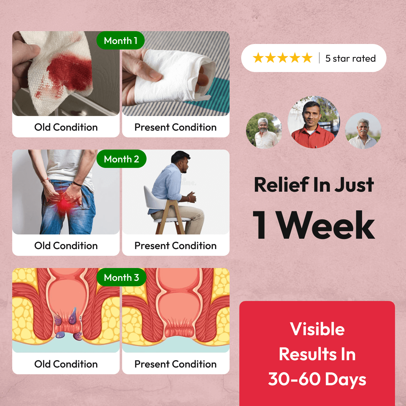 Dr Mantra Piles Care - Dr Mantra