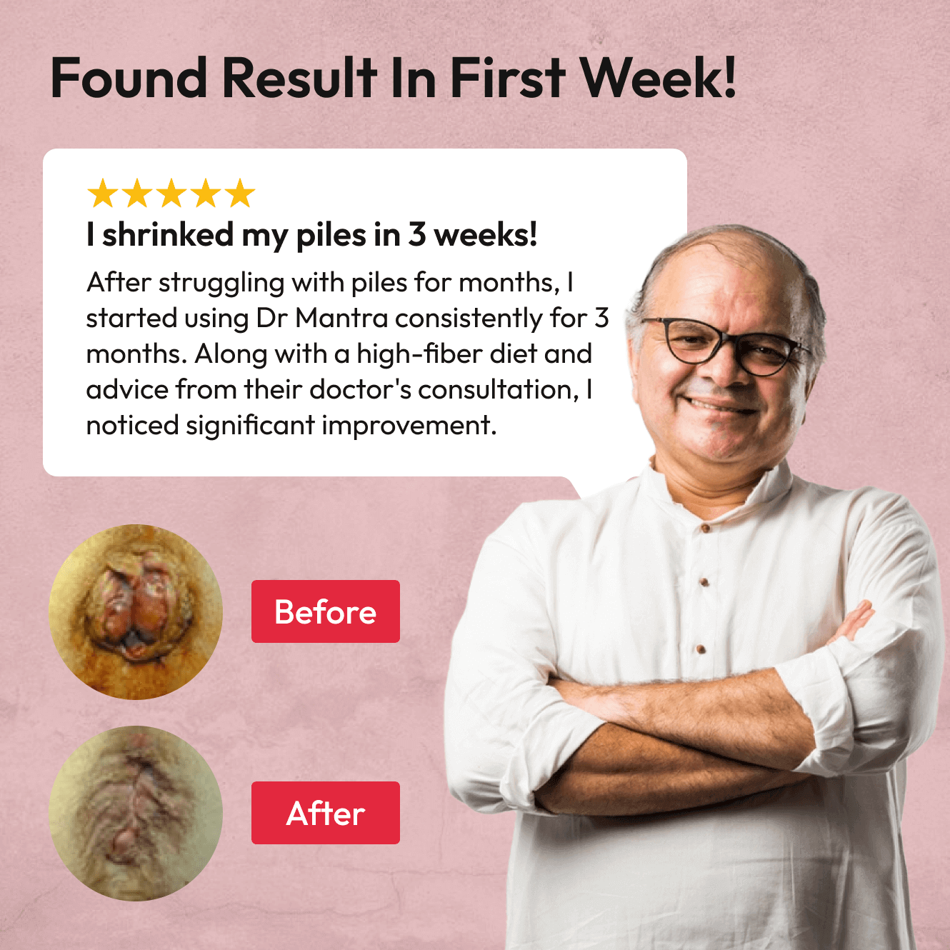 Dr Mantra Piles Care - Dr Mantra