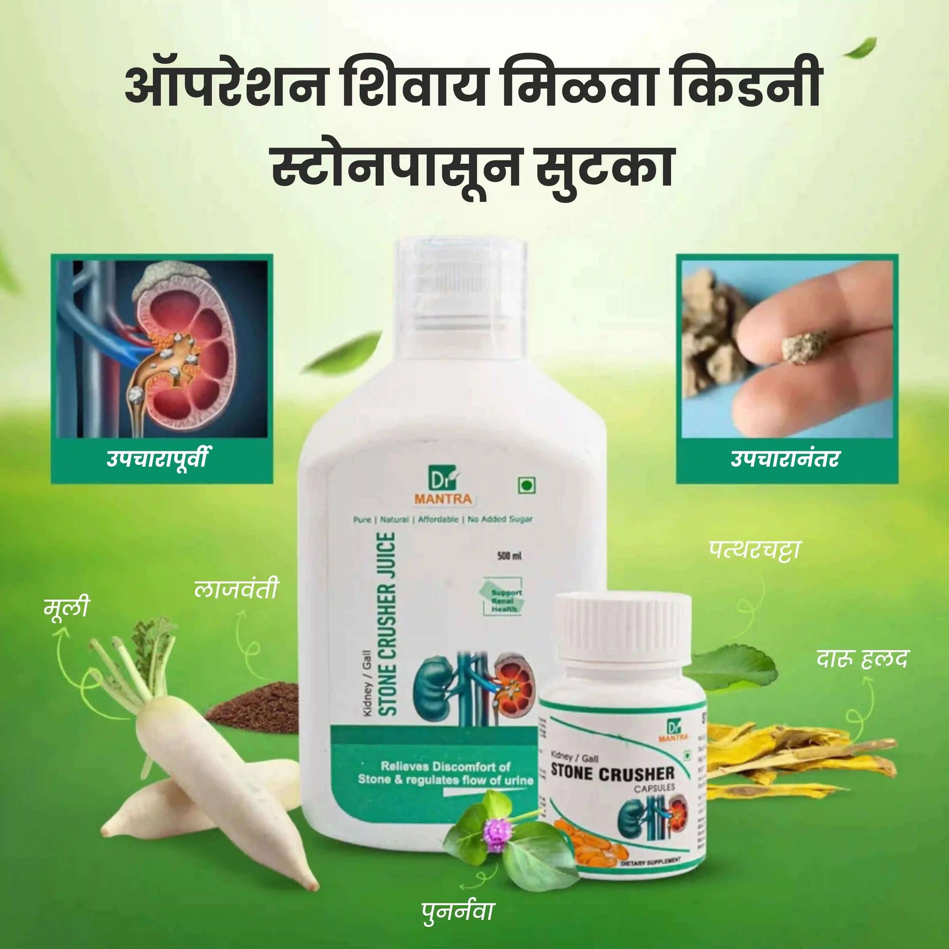 किडनी स्टोन क्रशर ज्यूस (फ्री डायट चार्ट व आयुर्वेदा एक्स्पर्ट कन्सल्टेशन) - Dr Mantra