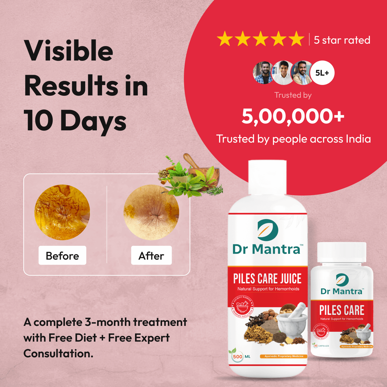 Dr Mantra Piles Care - Dr Mantra