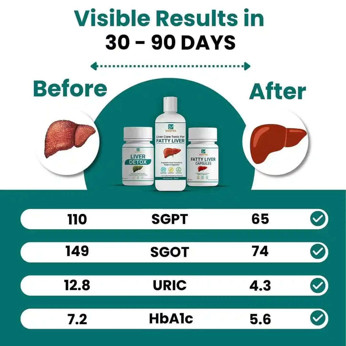 Say goodbye to fatty liver in few weeks + diet chart + doctor consultation (FREE) - Dr Mantra