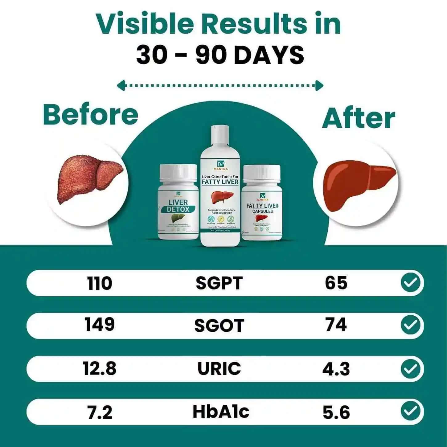 Say goodbye to fatty liver in few weeks + diet chart + doctor consultation (FREE) - Dr Mantra