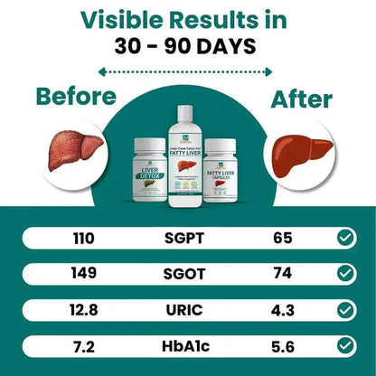 Say goodbye to fatty liver in few weeks + diet chart + doctor consultation (FREE) - Dr Mantra