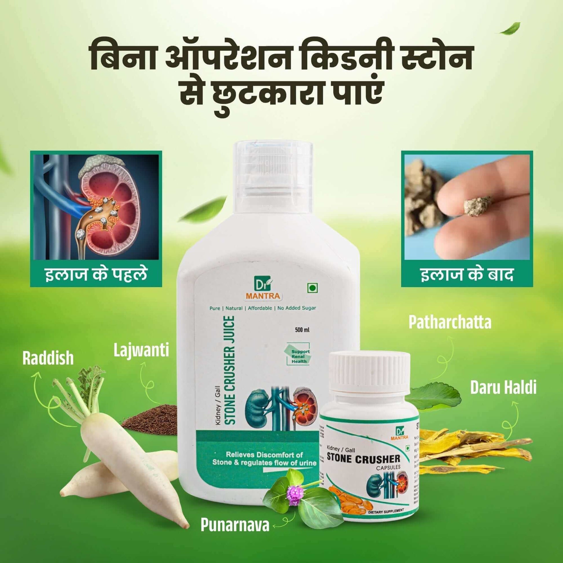 Kidney Stone Crusher Juice (Free Diet Chart & Ayurveda Expert Consultation ) - Dr Mantra