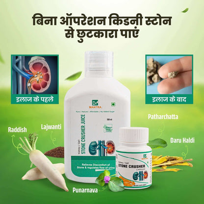 Kidney Stone Crusher Juice (Free Diet Chart & Ayurveda Expert Consultation ) - Dr Mantra